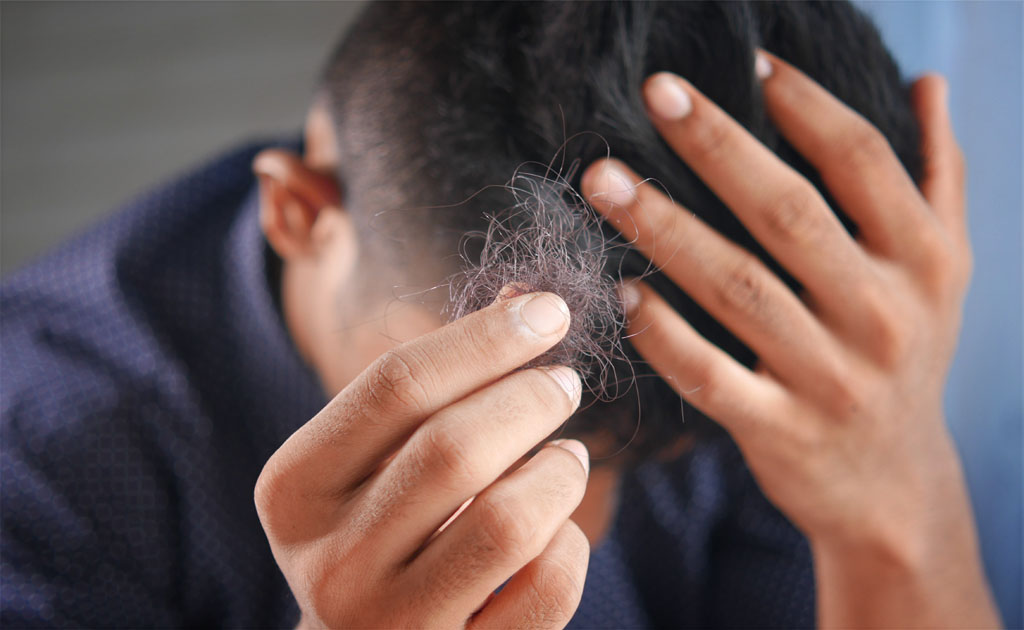 Leia mais sobre o artigo Sabonete de cetoconazol para caspa: a solução para a descamação